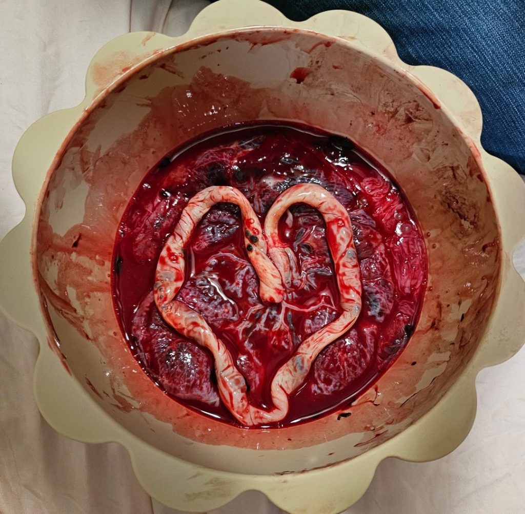 Redemptive pregnancy and birth, water&nbsp;birth